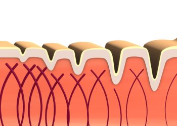 Collagene, cos’è e quali sono i suoi benefici?