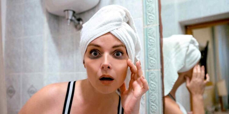 Come nascondere le occhiaie: Consigli e trucchi