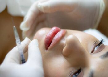Filler mandibolare: a cosa serve, come si fa e che tempi ha